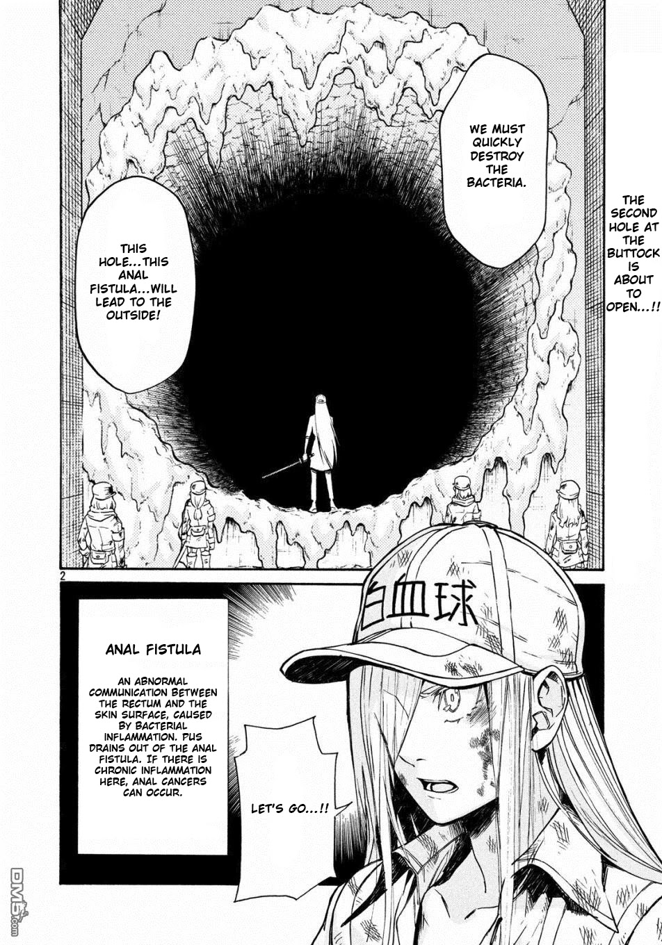 Hataraku Saibou Black - Chapter 22: Anal Fistula, Liability, Credit