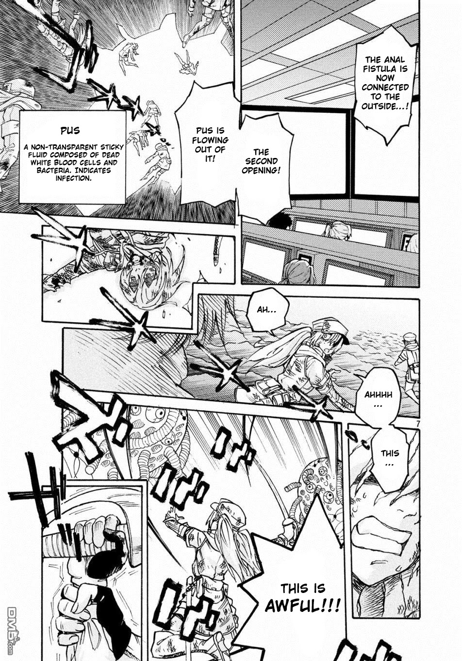 Hataraku Saibou Black - Chapter 22: Anal Fistula, Liability, Credit