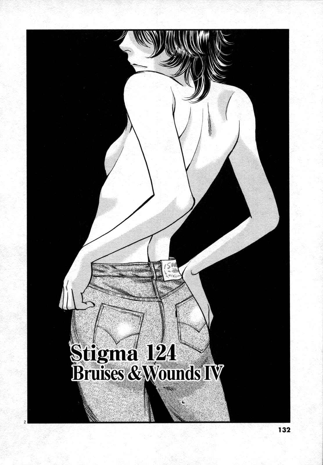 Kono S O, Mi Yo! - Vol.12 Chapter 124: Bruises &Amp; Wounds Iv