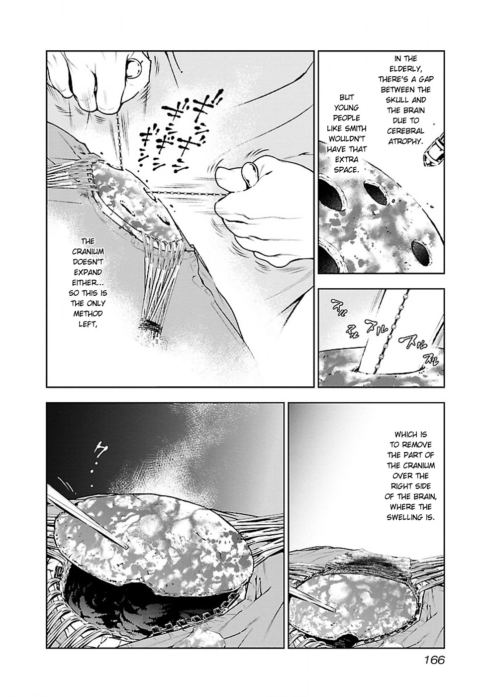 Young Black Jack - Vol.1 Chapter 7 : Deserters (3)